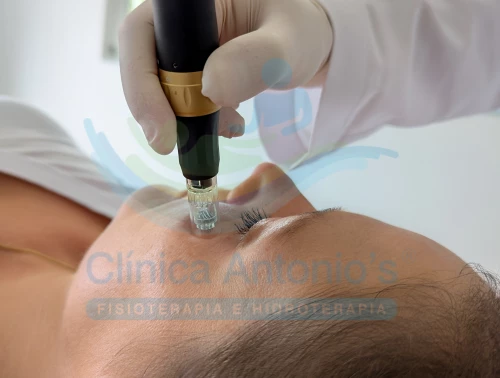 Cuidado com a pele na Menopausa