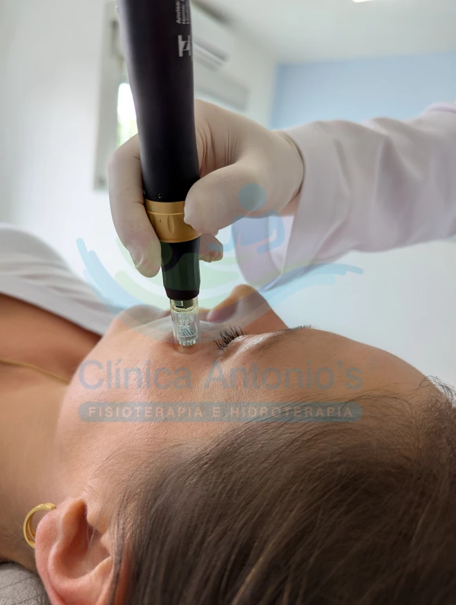 Cuidado com a pele na Menopausa